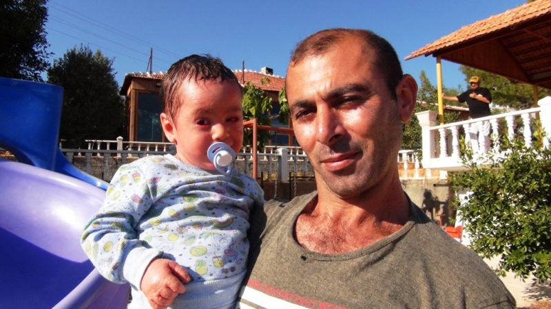 'Ölür'denilen balık pulu hastası küçük Rehime şifayı Türkiye'de buldu 